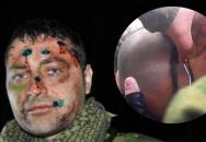 AirSoft občas bolí, aneb headshot a následná ,,operace