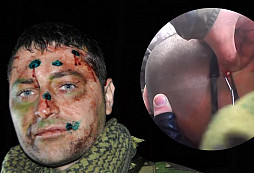 AirSoft občas bolí, aneb headshot a následná ,,operace